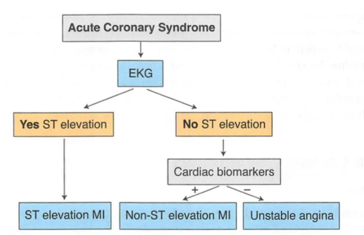 Sorting acute coronary syndrome: the electrocardiogram comes first. ST elevation means ST-elevation MI. Without ST elevation, cardiac biomarkers decide: raised means non-ST-elevation MI, normal means unstable angina.