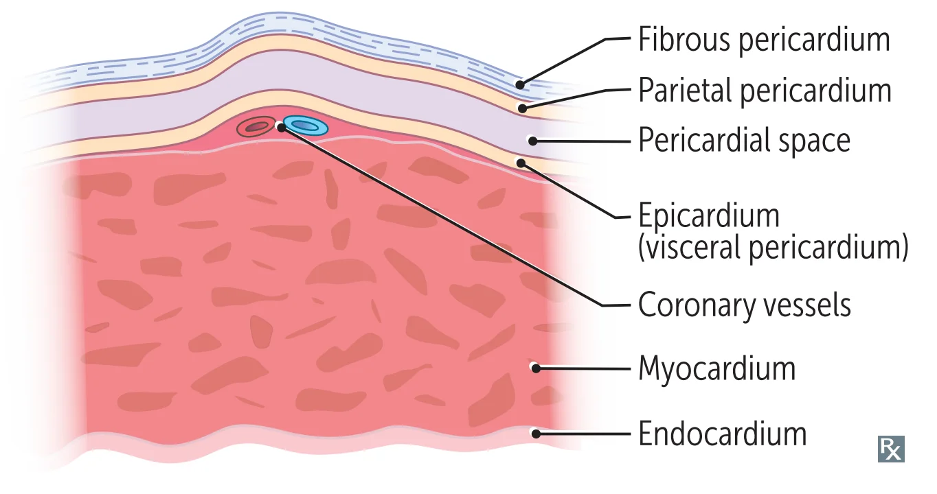 The pericardial layers from outside in: the tough fibrous pericardium, then the parietal pericardium, then the pericardial space, then the epicardium (visceral pericardium) which carries the coronary vessels within it, then the myocardium and finally the endocardium lining the chamber. Fluid in a pericardial effusion collects in the space between the parietal pericardium and the epicardium, and the coronary arteries running in the epicardial fat is why they are compressed late rather than early in tamponade.