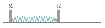 Tricuspid regurgitation on a phonocardiogram: a holosystolic murmur that runs from S1 to S2, heard at the left lower sternal border and louder on inspiration.