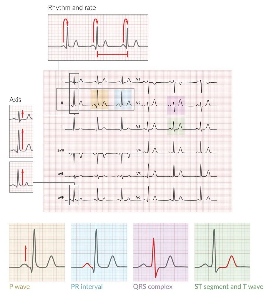 The systematic ECG read on a 12-lead tracing: rhythm and rate from the R-R intervals, axis from leads I and aVF, then each component in turn, P wave, PR interval, QRS complex, and ST segment and T wave.