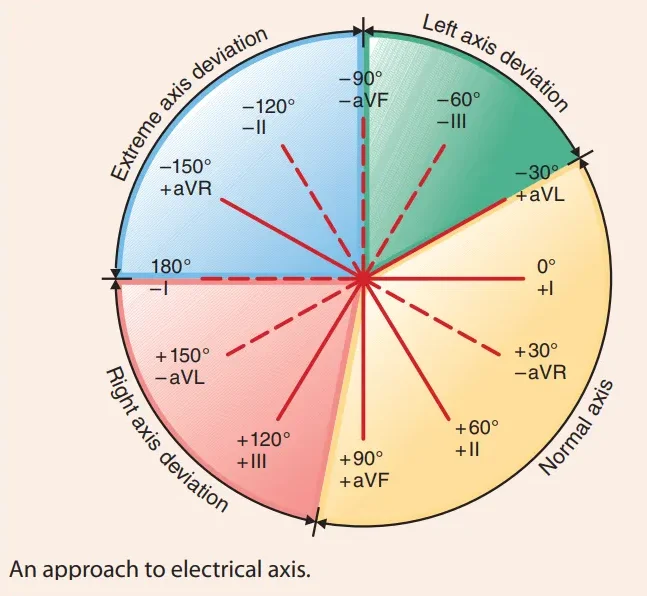 The electrical axis wheel: normal axis from -30° to +90°, left axis deviation from -30° to -90°, right axis deviation from +90° to 180°, and extreme axis deviation in the upper left quadrant, with the lead that points to each angle marked.