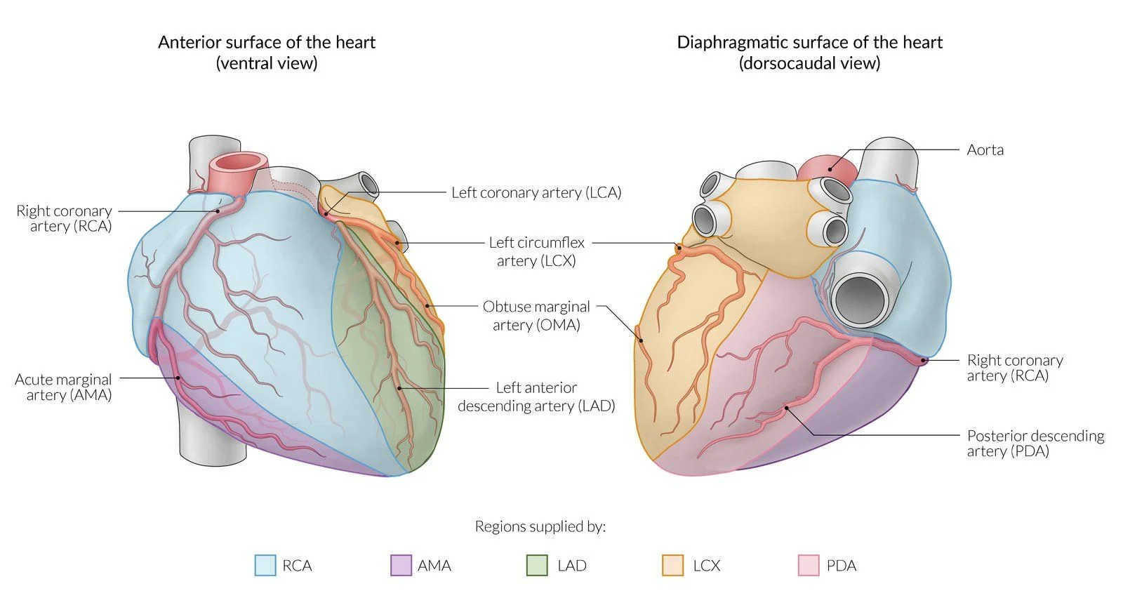 Regions supplied by each coronary artery, front view (left) and diaphragmatic view (right). Blue, right coronary artery; purple, its acute marginal branch (right ventricle); green, left anterior descending (front of the septum and anterior left ventricle); orange, left circumflex (lateral wall); pink, posterior descending artery (back of the septum and the inferior wall).
