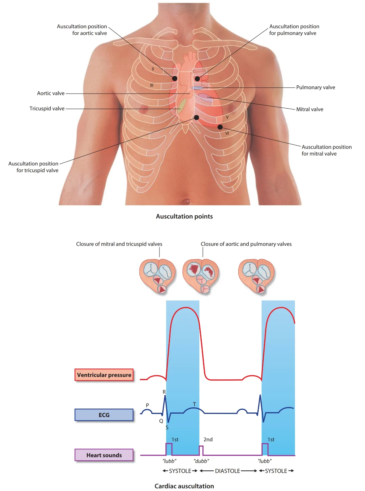 Valves and where to listen. Top: the anatomical position of each valve (dots) and its auscultation point (circles), each point lying downstream along the direction of flow. Bottom: the first heart sound is the closure of the mitral and tricuspid valves at the start of systole; the second is closure of the aortic and pulmonary valves at the start of diastole.
