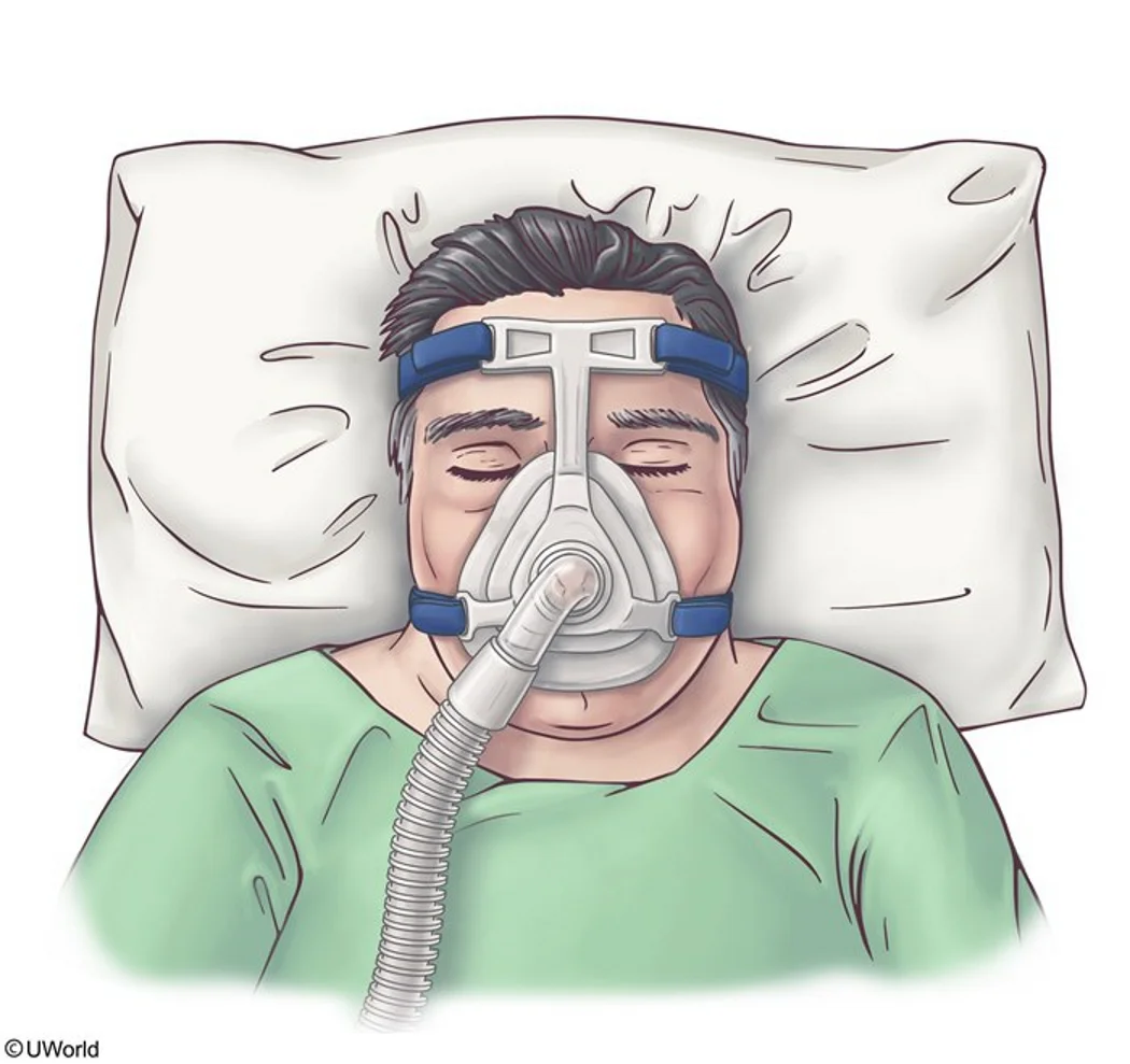 Non-invasive positive-pressure ventilation through a tight full-face mask: it pushes fluid out of the alveoli and lowers preload and afterload, which is why it treats acute pulmonary edema rather than only supporting breathing.